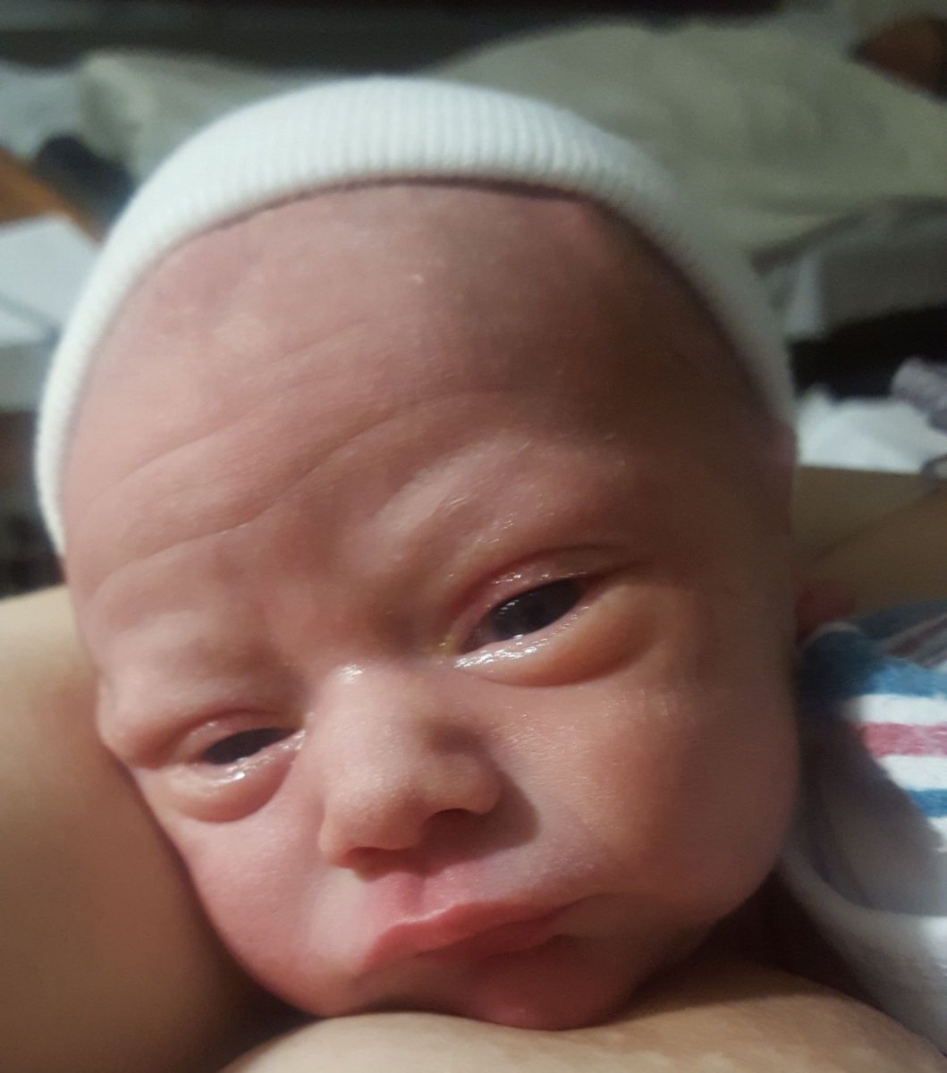 courtneyanne00's tweet photo. #csectionawarnessmonth 🖤  21 hours of being in a labor, heart rate would decrease every time I had a contraction. I remember the doctors running in saying "we've got to do this quick, your having a emergency c-section." blessed with my blue eyed baby who I get to call my son. 💗 https://t.co/TOFaETA9lv