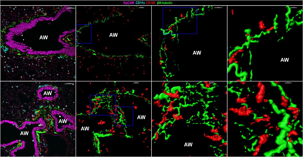 In addition to alveolar macrophages (a population well known to defend against viral infection flu etc..), populations of interstitial macrophages.... 1) nerve & airway associated macs (NAM) CD169+/CX3CR1+ 2) interstitial macs (CX3CR1-).Look, the NAMS hug up against nerves!