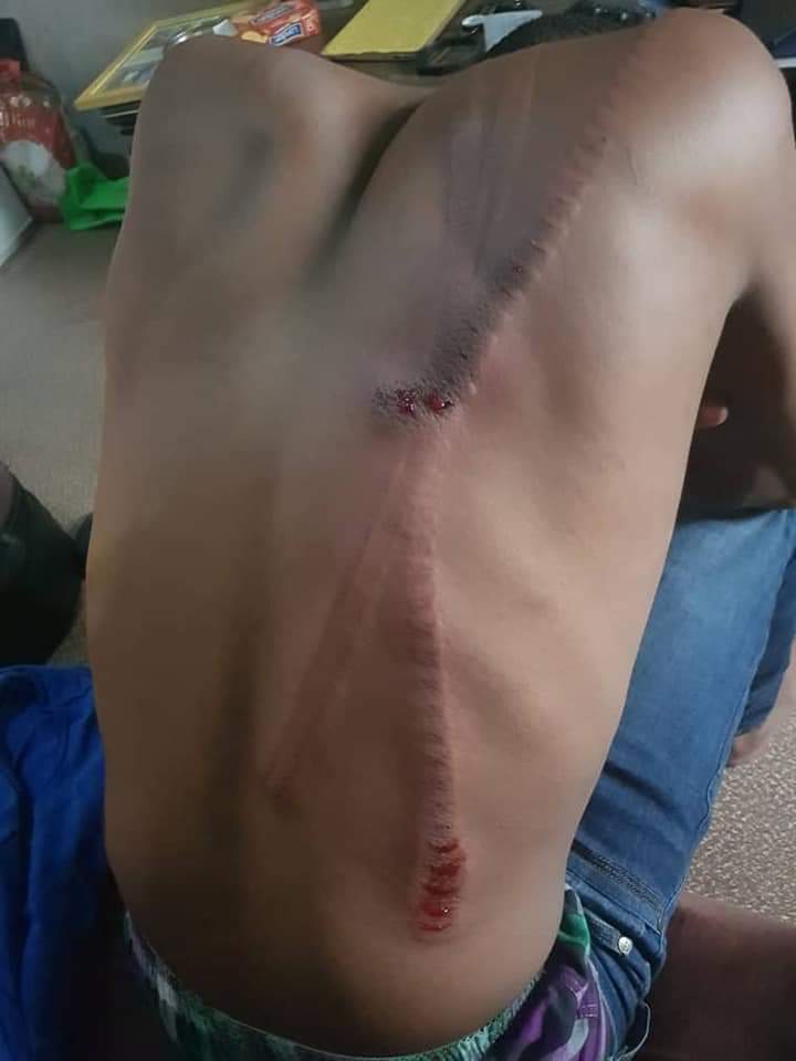 #COVID19TG: Pdt le couvre-feu, voici l'œuvre des militaires &amp; policiers suivant les instructions de #Faure &amp; #Yark, un homme brute et brutal. #Togodebout <a href="/AmnestyTogo/">Amnesty International Togo</a> #LTDH #FIDH #HRW #OMCT #APT #ACHPR #AfCHRP <a href="/CohenOnAfrica/">Herman J. Cohen</a> <a href="/guyverhofstadt/">Guy Verhofstadt</a> <a href="/EP_President/">Roberta Metsola</a> <a href="/AmbUETogo/">UE au Togo</a> #rfi #Africa24