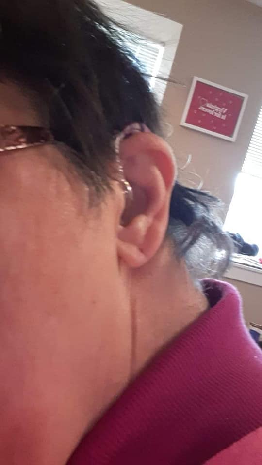 My name is Ginny and I am a self-advocate and I need Medicaid to help pay for my two devices that help me hear better. #nomedicaidcuts