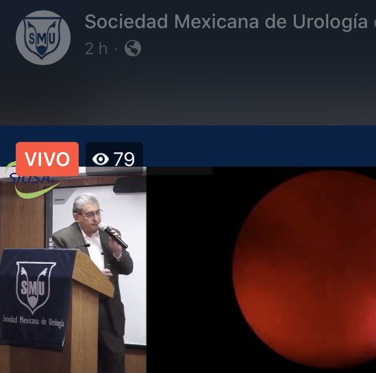 DrFRodriguezCov's tweet photo. Todo un éxito la sesión mensual VIRTUAL de @smumexico con el apoyo de #SIUSA
Más de 350 participantes en línea
Temas de actualidad: #COVID19mx y Urología / #NLPC y #ShockPulseSE
Ponencias de alta calidad
@ArroyoCharlie @AqcQuiroz @drgcatalan @melchorcastro https://t.co/eRMbwvHs03