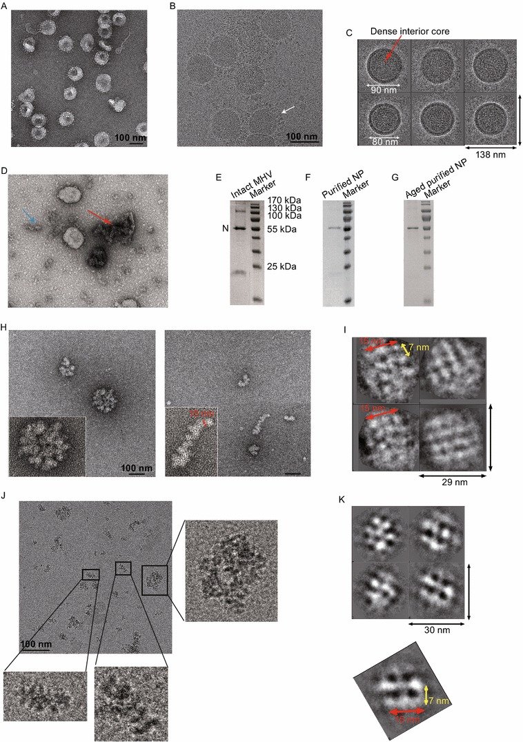 Electron microscopy studies of the coronavirus: 2017 https://www.ncbi.nlm.nih.gov/pmc/articles/PMC5326623/