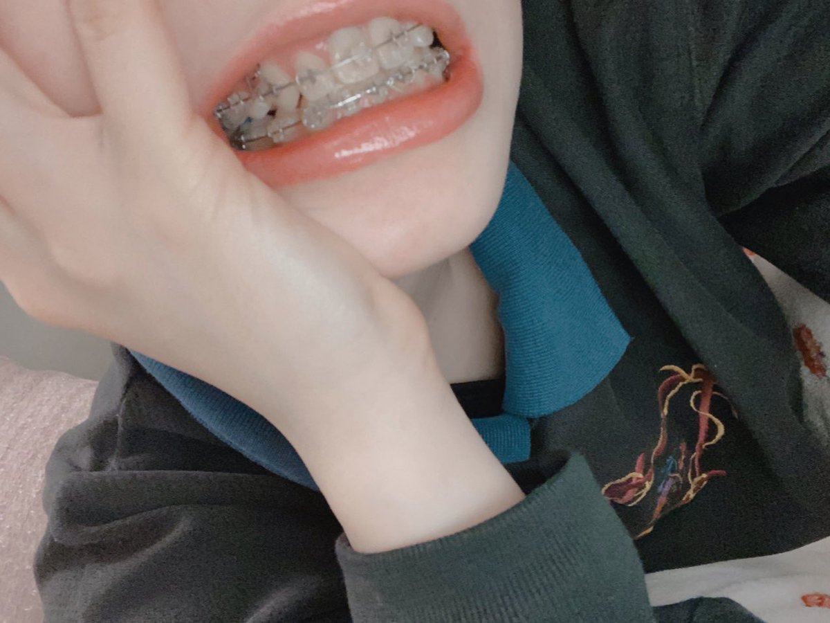 mayu_ExWHYZ's tweet photo. #歯 https://t.co/hk2iS4hkUL