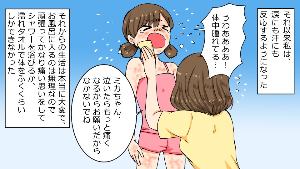 ダヴィンチアカデミー 漫画 水アレルギー になるとどうなるのか 2億人に1人の奇病 動画版はこちら T Co 1clefgqcl0