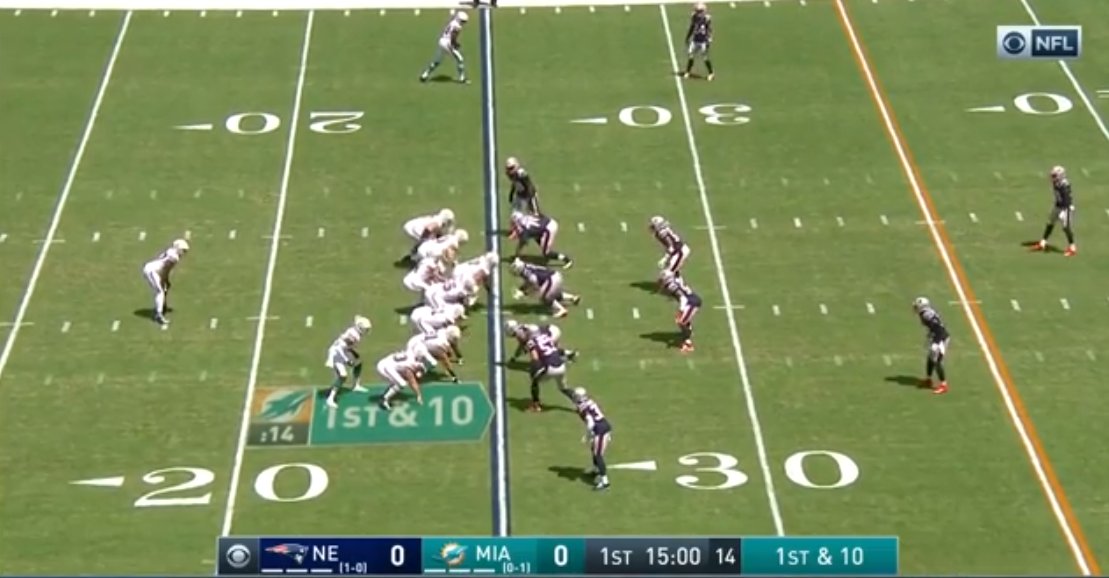 Against the Dolphins last season.3 down linemen.a 1-tech [nose tackle] and 2 DEs outside the tackles] in my book. The extra TEs confse it slightly.With two edge players in a 2-point stance way wide.