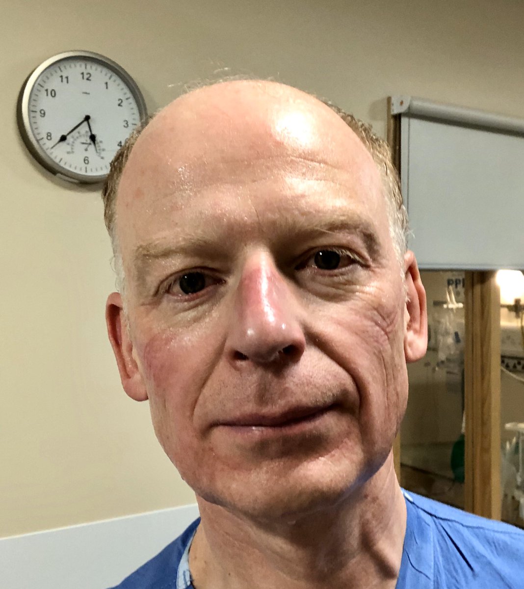 This is what just three nights on an CoVid19 Intensive care unit feels like. A unit that didn’t even exist two weeks ago. A baptism of fire back into ICU care after nearly 20years. Remember this is just the start of this. I would quite like my day job back at the end of this 🙏🏼