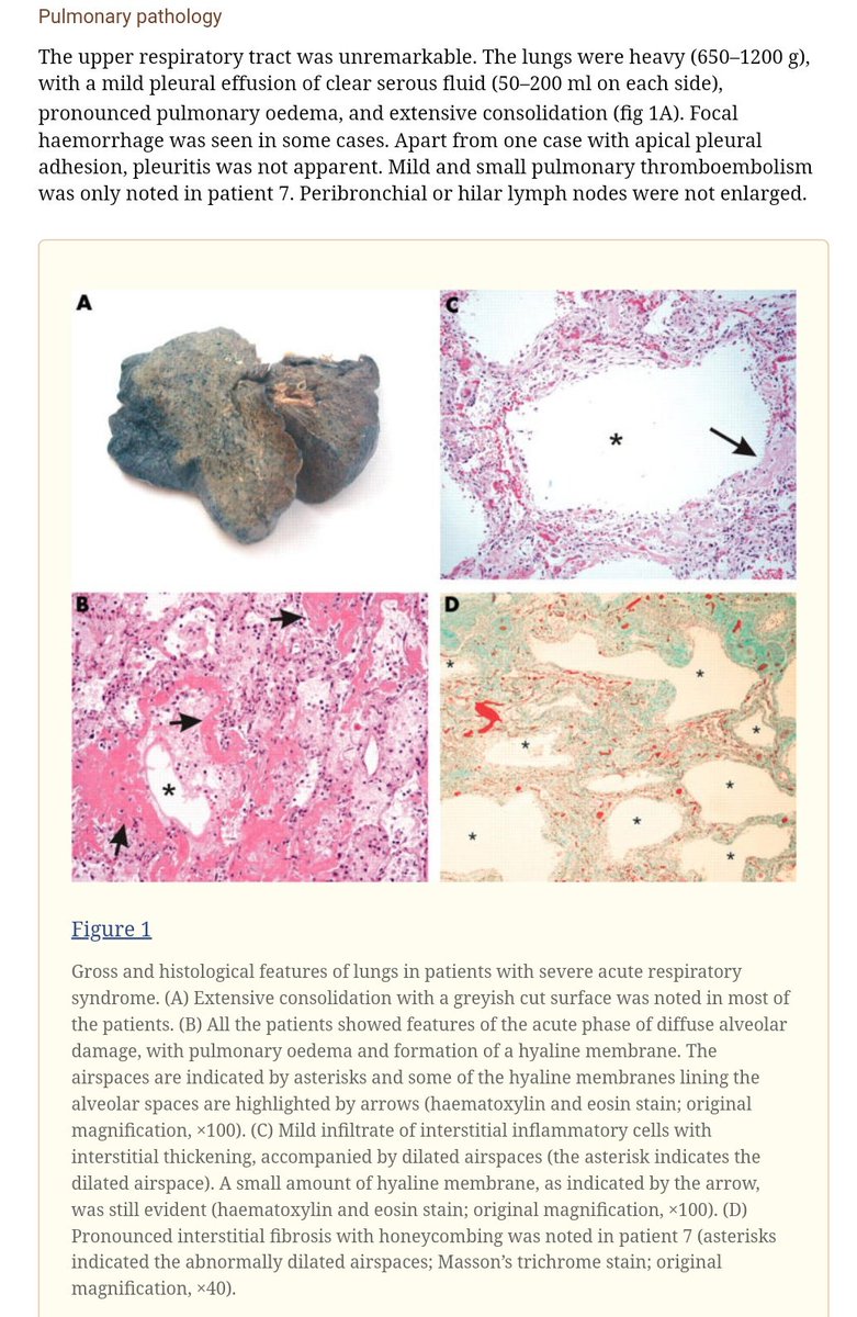 Lung samples from fatal SARS cases were collapsed, edematous, fibrotic, and greyish, with heavily disrupted microstructure. COVID-19 is presumably similar. https://www.ncbi.nlm.nih.gov/pmc/articles/PMC4531190/Inflating such lungs with positive pressure requires high levels thereof.