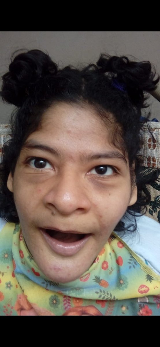 FrancoFeliziani's tweet photo. @ZENAIDASOLISG CLARA LAURENCIO CORNEJO CON DNI 46533183,INCLUIDA DENTRO DEL SISFOH, SIENDO PERSONA VULNERABLE POR TENER RETARDO MENTAL SEVERO INSCRITA EN EL CONADIS,INICIALMENTE SALIO COMO BENEFICIARIA DEL BONO PERO HOY REBIZANDO NO SE ENCUENTRA EN EL SISTEMA PARA EL BONO. https://t.co/vcMhufOtT7