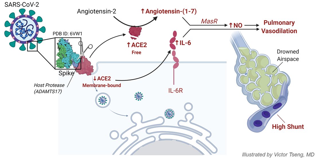 VectorSting's tweet photo. Physiology of #COVID19 pneumonitis has the gist of shunt way out of proportion to lung injury. This suggests specific dysregulation of the pulmonary vascular compartment. Here is a hypothesis to explain why this might be the case, involving proteolysis of ACE2. https://t.co/tboeuSaaaa