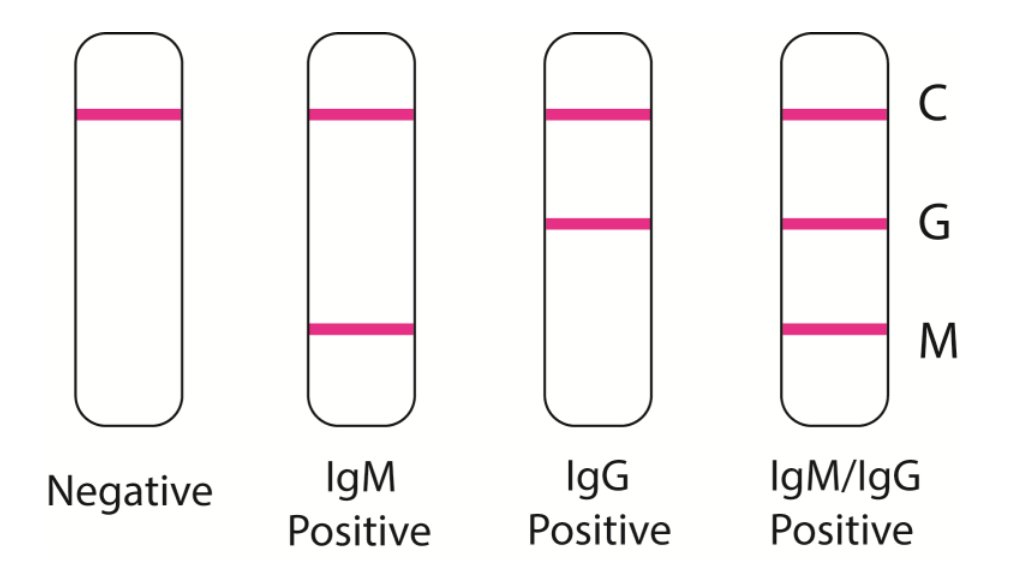 Most  #coronavirus infection/immunity tests look like a pregnancy test. A drop of blood/serum is placed on a stick. In <10 min, 1, 2 or 3 lines appear: C = +ve control, spiked IgM & IgG anti-CoV-2, test worked.G = IgG = seroconverting/immuneM = IgM = acute/recent infection 5/8