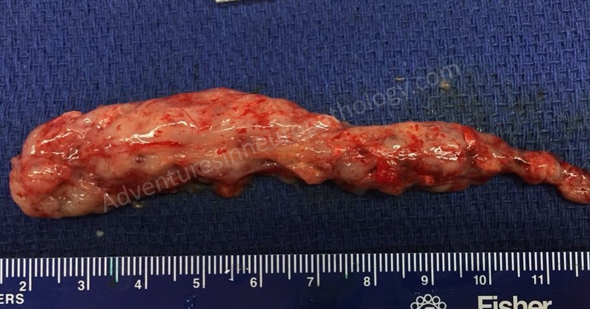 Adventures in Neuropathology tweet media