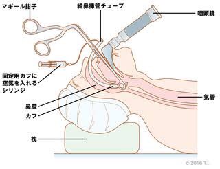 人工呼吸器のtwitterイラスト検索結果
