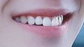 2. jungwoo look at how much his central incisors stick out i have enough energy to power a entire city ohmygod. the contrast between his long central incisors and his shorter outer incisors is absolutely beautiful. teeth are also round and would feel nice to be chewed on by