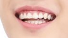 1. doyoung his teeth overlap nice. the amount of gum visible in his smile is incredible i love the way his teeth connect into his gum. his central incisors r sharp and straight while his outer incisors/canines/premolars are more round and cute and the contrast is comforting