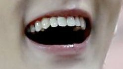 4. mark marks teeth are the most adorable thing ever. every tooth looks like their own individual yet they all connect together perfectly. extra points for how well they match his personality; theyre soft and round they look they would never hurt anything ever like he wouldnt