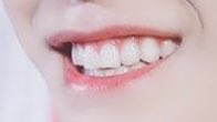6. taeyong none of his teeth are perfectly straight execpt for his incisors rlly. love how wide his teeth are but yet they are still so small it’s the cutest thing ever god the way u can see the teeth under his gums is so adorable i’ll cry. i think he still has his baby teeth