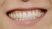5. yuta his teeth are so long and nice ohmygod. all four of his incisors are straight and aligned and his canines are tilted towards his incisors which really highlights them and points out how perfect they are. i love how much his canines stand out where they’re in his gums