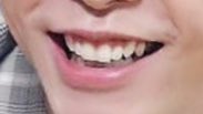 10. johnny i love the way his teeth look too small for his mouth when he smiles more with his lips it’s adorable however at the same time he has rather big teeth. his first premolar is so sharp but it also looks so delicate i love the contrast in this mans mouth oh god