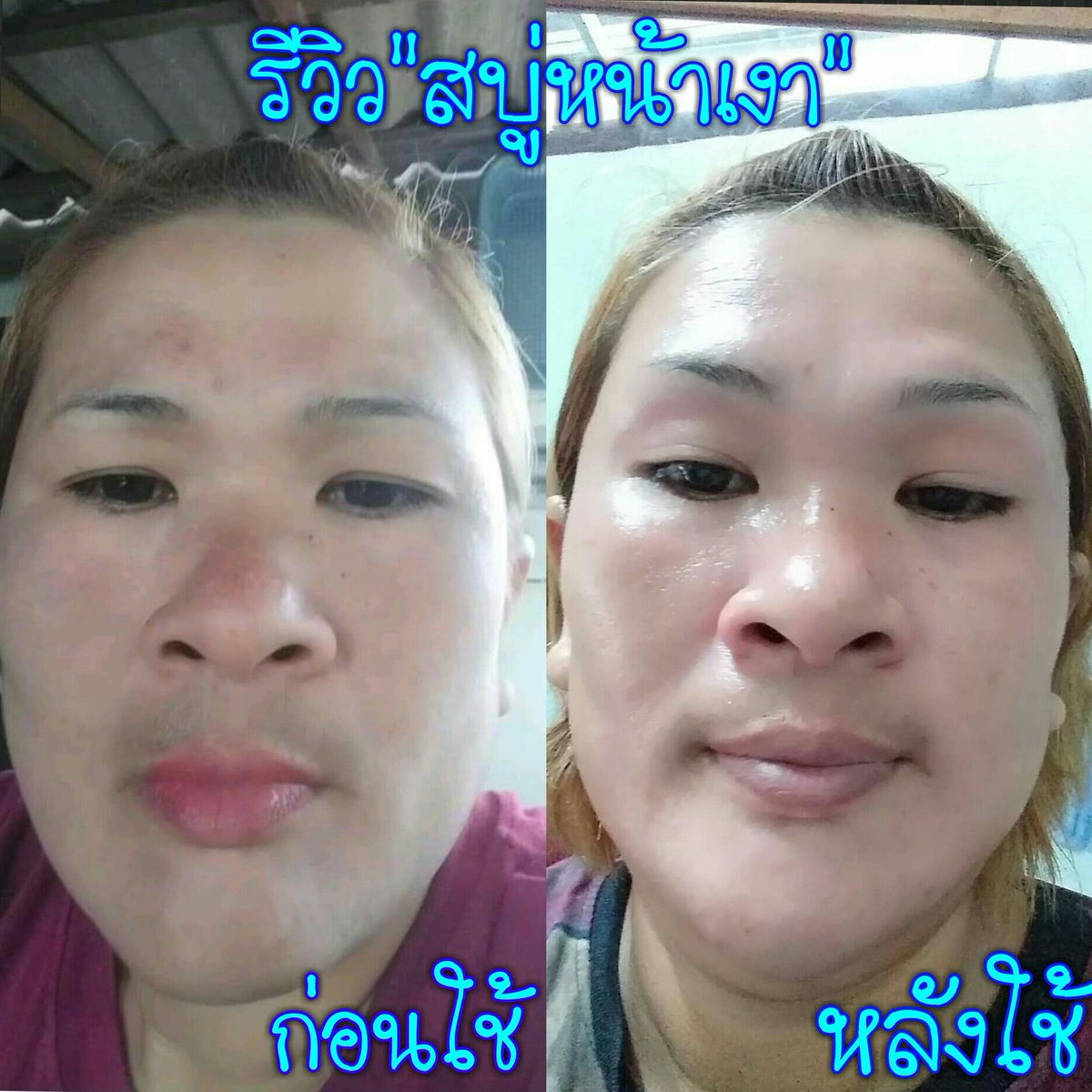 by_psc's tweet photo. 🔺ใช้ไปก้อนเดียวเอง 
หน้าดีขึ้นมาก #ฝ้าจางลง #หน้าใสขึ้น
#สบู่หน้าเงา https://t.co/RCWJLx2NLL
