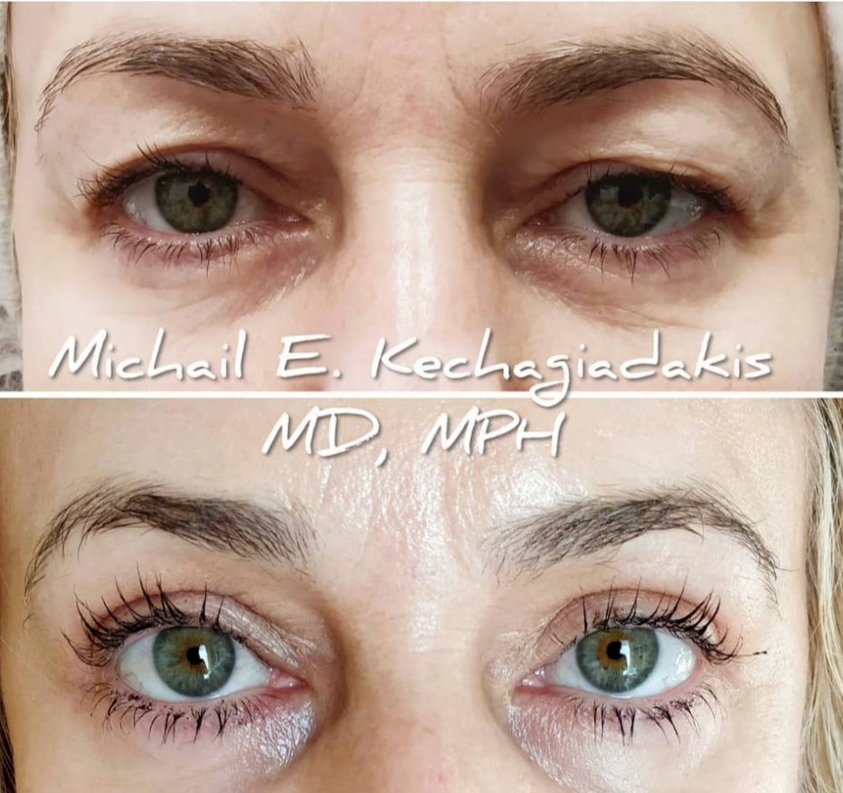 NeoGenPlasma_RSA tweet media