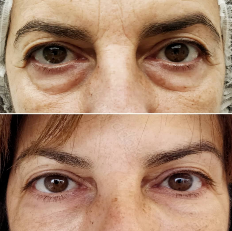 NeoGenPlasma_RSA tweet media