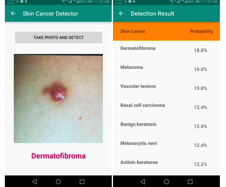 nDroidJava's tweet image. #DeepLearning based skin #cancer detection for #android #devices with #cloud-based inference - #AndroidDev #health #healthcare #MachineLearning #Python #Flask #DataScience #APIs #FastAI #ArtificailIntelligence #medical #mobiledev - #opensource #github > bit.ly/2XQjZXk
