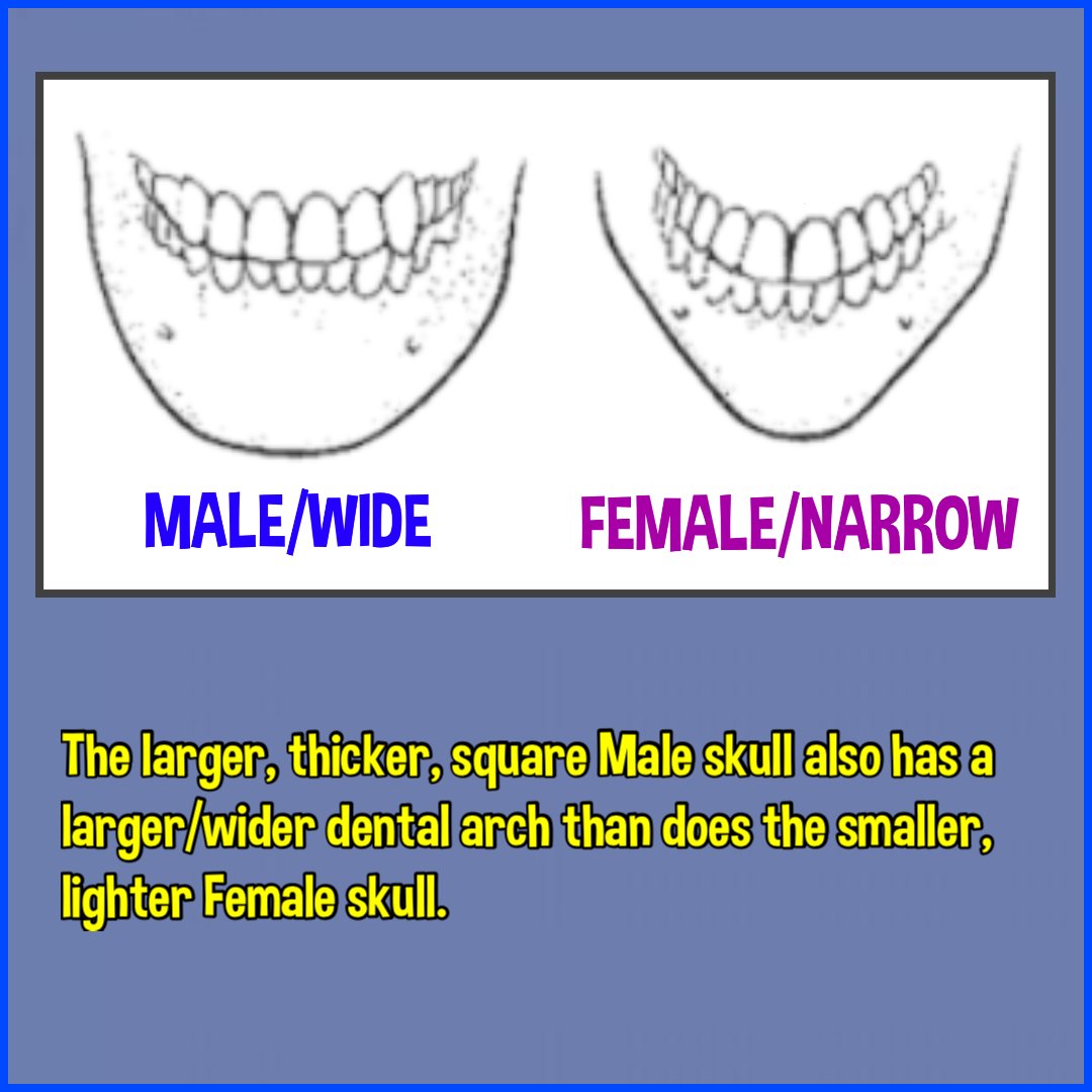 WHEN DENIED ACCESS TO A PELVIS FOR EXAMINATION WHEN DETERMINING A SKELETON’S GENDER, WE LOOK TO OBTAINING A CONSENSUS OF GENDER MARKERS INSTEADA SKELETON’S DENTAL ARCH IS ONE OF THOSE MARKERS AS ALWAYS, THE ROYALS ARE EFFECTIVE TRANS-SUBJECTS