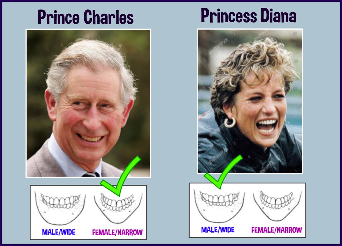 WHEN DENIED ACCESS TO A PELVIS FOR EXAMINATION WHEN DETERMINING A SKELETON’S GENDER, WE LOOK TO OBTAINING A CONSENSUS OF GENDER MARKERS INSTEADA SKELETON’S DENTAL ARCH IS ONE OF THOSE MARKERS AS ALWAYS, THE ROYALS ARE EFFECTIVE TRANS-SUBJECTS