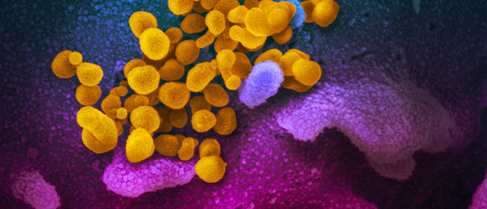 🔈Nueva nota informativa sobre enfermedad inflamatoria intestinal (EII) y coronavirus de <a href="/geteccu/">GETECCU</a> 

✅Los síntomas de la #Covid_19 
✅Los test que detectan al virus y a sus anticuerpos.
✅Registro de los datos de personas con EII y coronavirus

🔗accuesp.com/actualizacion-…