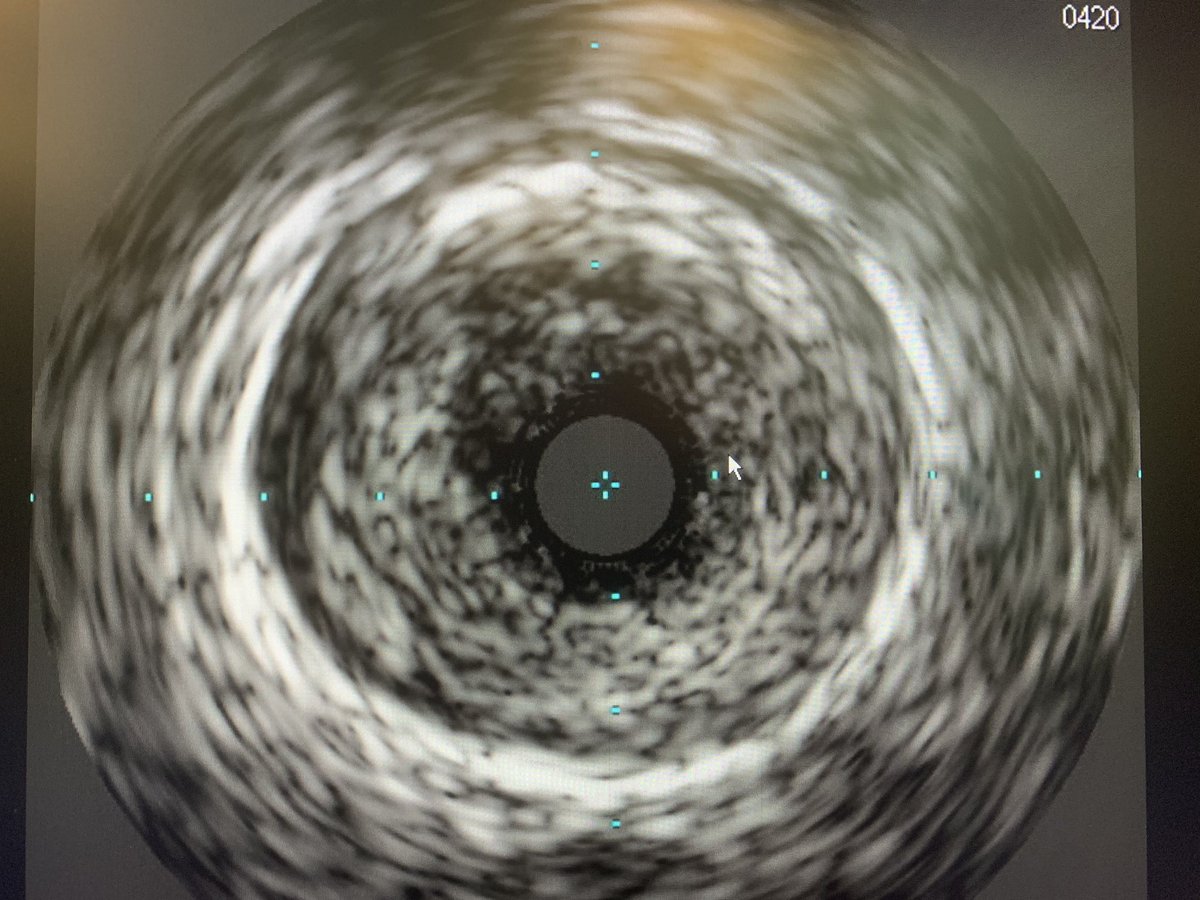 Abdallah Bitar MD PhD tweet media