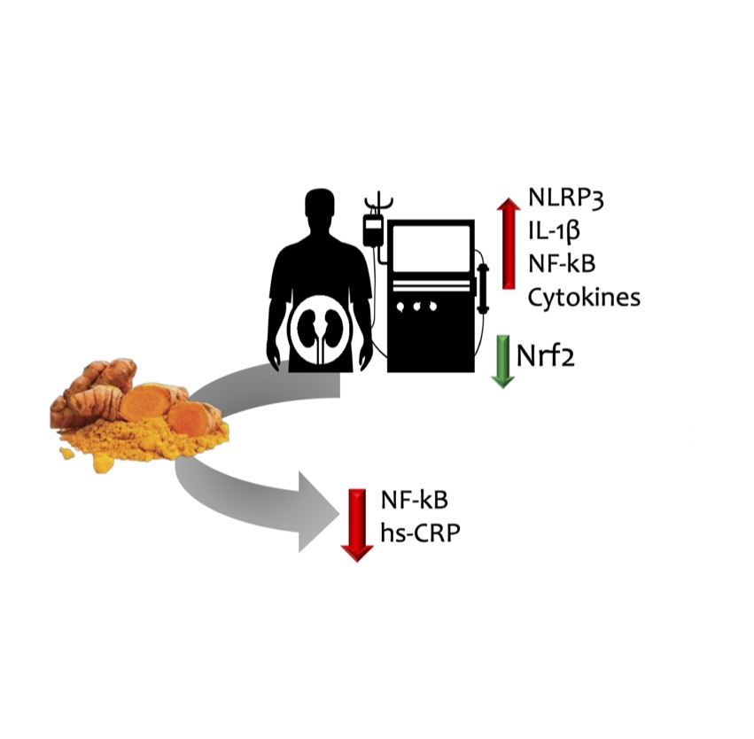 Renal Nutrition UFF (@renaluff) on Twitter photo Our recent article about curcumin supplementation on inflammatory transcription factors in hemodialysis patients.
@dmafra30 @denisfouque1 <a href="/StenvinkelPeter/">Peter Stenvinkel</a>
#KidneyDisease #Curcumin #bioactivecompounds #inflammation #nutrition
Access the article: clinicalnutritionjournal.com/article/S0261-β¦ Our recent article about curcumin supplementation on inflammatory transcription factors in hemodialysis patients.
@dmafra30 @denisfouque1 <a href="/StenvinkelPeter/">Peter Stenvinkel</a>
#KidneyDisease #Curcumin #bioactivecompounds #inflammation #nutrition
Access the article: clinicalnutritionjournal.com/article/S0261-β¦
