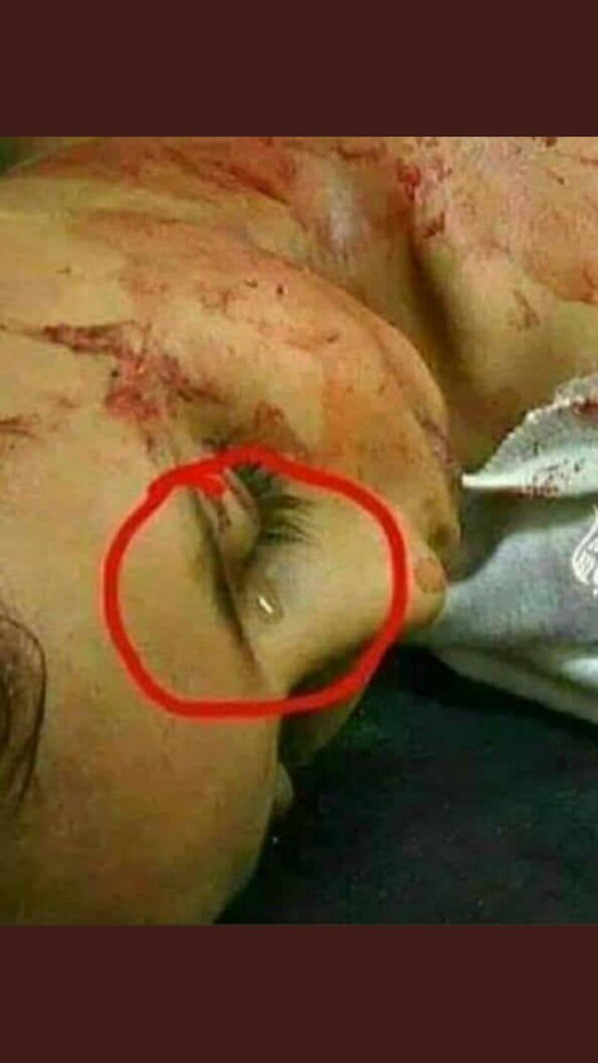 ALKRAR_ALYEMENY's tweet photo. او کشته شد و اشک خشک نشد 💔💔

اگر تحت تأثیر این جنایت شرم آور قرار نگیرد
 بدانید که قلبی سنگ دارید

 کودکان یمن 😔

 خدا آل سعود را نفرین کرد https://t.co/ALDVA8qxJ9