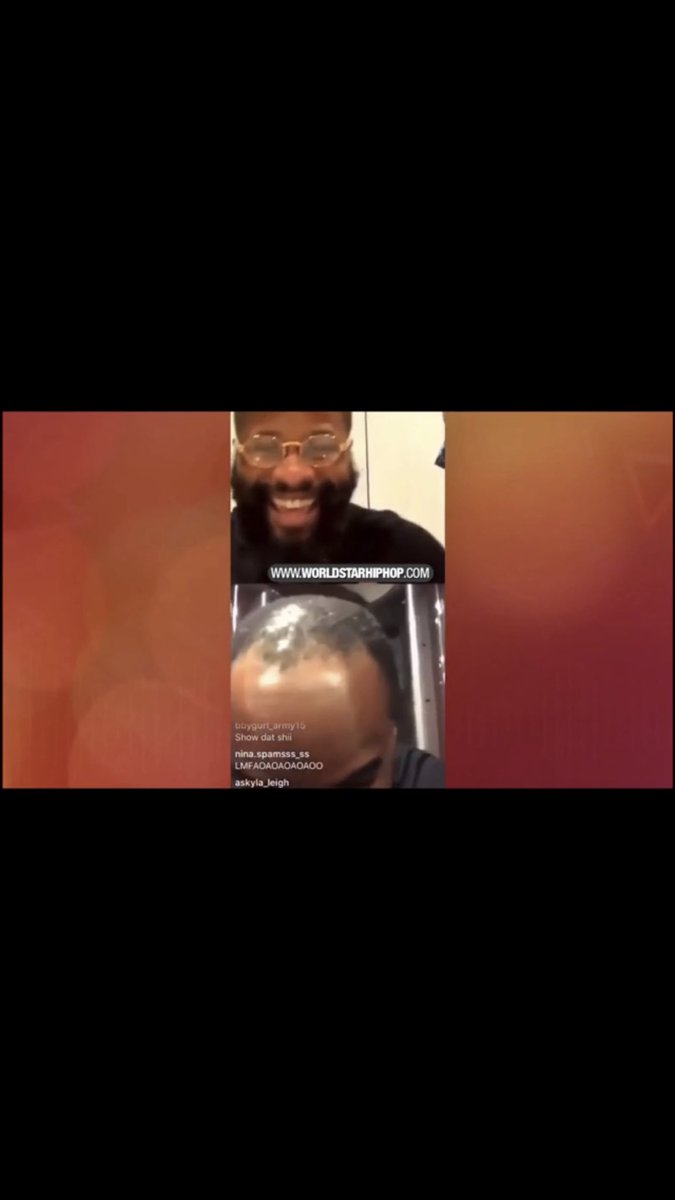 rambopenny28's tweet photo. @cthagod we got the same hairline lol 😂😂 https://t.co/lA5jCAMYyv