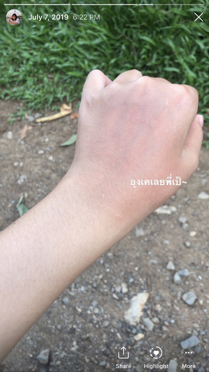 cqeener's tweet photo. อยากจะลองรีวิวคอลลาเจนของ #anacolly ที่กินมาก็คือดีเวอร์ ผิวเนียนมาก จากตอนแรกกลับจากเข้าค่ายแต่ใส่ปอกแขนไปมือเลยดำเลยลองสั่งมากินกอนไปแปบเดียวคือนางกลับมาใสแล้ว แต่ไม่มีรูปง่าาา ลืมถ่ายไว้ มีแต่อันนี้ไปหามาในสตอรี่ รูปแรกคือวันแรก อีกรูปคือกินมา10วัน แกร่คือดี #anacollyreview https://t.co/n76nvhOBjv