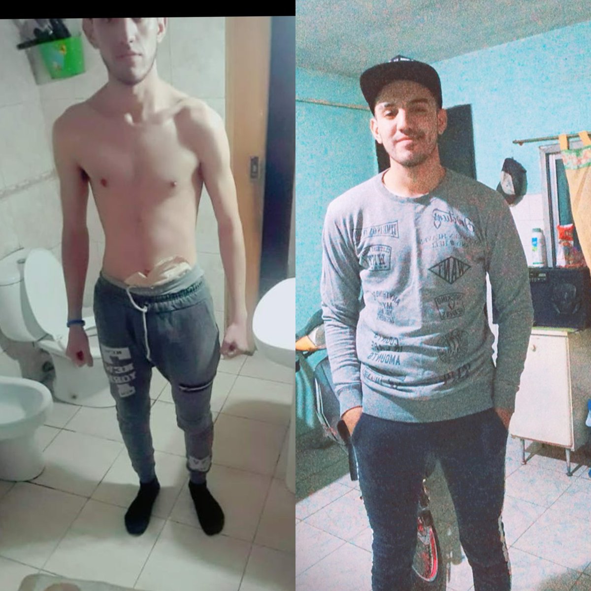 MGeanechini's tweet image. *Todo cuestión de actitud* unas de mis frases favoritas; ya que con esa frase me propuse a salir adelante después de mi enfermedad que casi acaba con mi vida. 🔥 
De cuando tenía 18 y la última de ahora con 21♥️