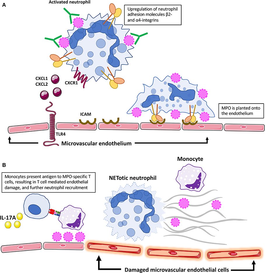 Kitching Laboratory (@kitchinglab) on Twitter photo Thanks to <a href="/LaniShochet/">Lani Shochet</a> nephrologist for all her work on this excellent and comprehensive review of experimental ANCA-associated vasculitis in <a href="/FrontImmunol/">Frontiers - Immunology</a>. Nice part of PhD lit review too! <a href="/RELENT_EU/">RELENT project</a> <a href="/SCSMonash/">Monash University School of Clinical Sciences</a> Thanks to <a href="/LaniShochet/">Lani Shochet</a> nephrologist for all her work on this excellent and comprehensive review of experimental ANCA-associated vasculitis in <a href="/FrontImmunol/">Frontiers - Immunology</a>. Nice part of PhD lit review too! <a href="/RELENT_EU/">RELENT project</a> <a href="/SCSMonash/">Monash University School of Clinical Sciences</a>