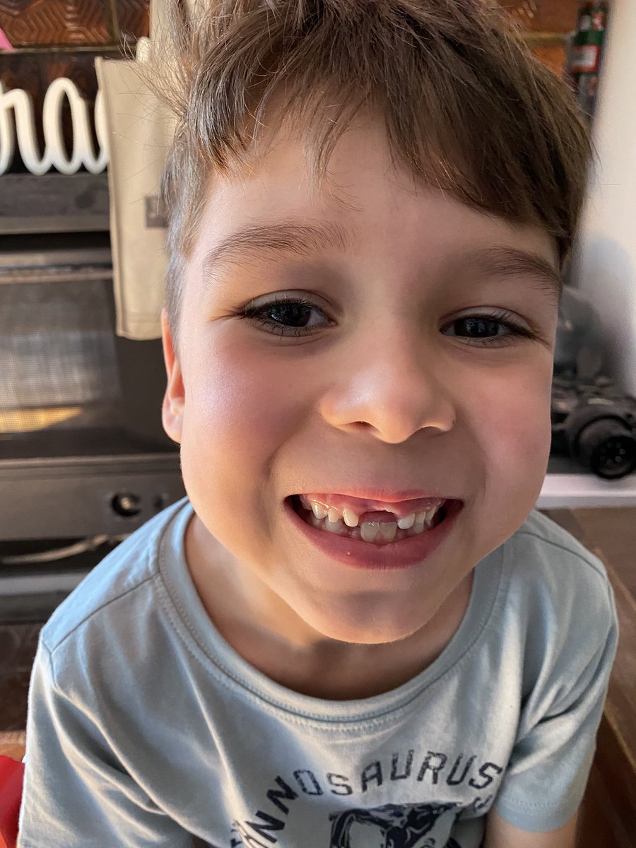 imTHATmumxoxo's tweet photo. This kid is robbing me... *cough cough* I mean the tooth fairy π§ββοΈ π¦·
#gummy #toothless #richkid #impoornow https://t.co/FlqYsM3na4