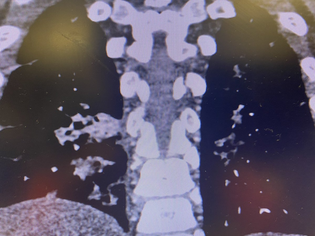 jeremyfaust's tweet image. Everyone: so how was your last shift?

Me:  TEST. EVERYBODY.

Er’yone: Even the the guy with musculoskeletal pain?

Me: TEST. EVERYSINGLEBODY.