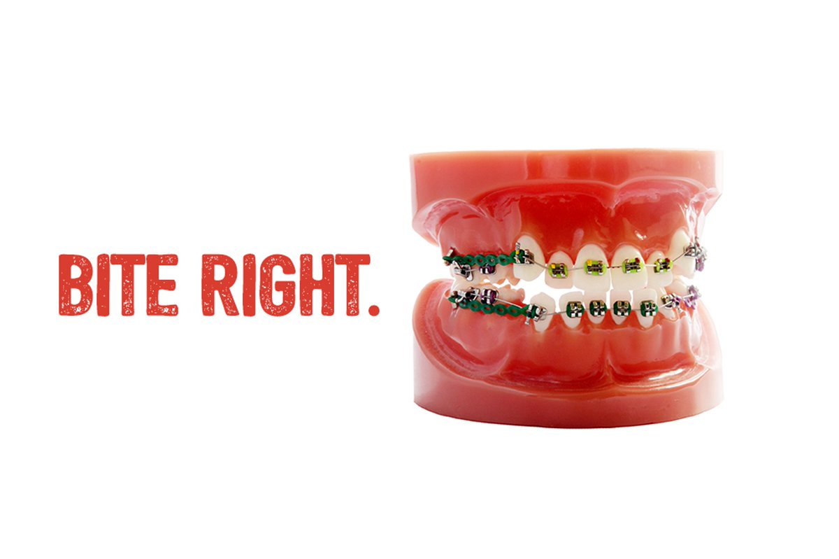 BracesAlbany's tweet image. Orthodontics aren't just for making your teeth look straight; many #orthodontic treatments are designed to fix #biteproblems. Whether it affects chewing, breathing, sleeping, or speaking, a properly-aligned bite is much more than a cosmetic consideration.