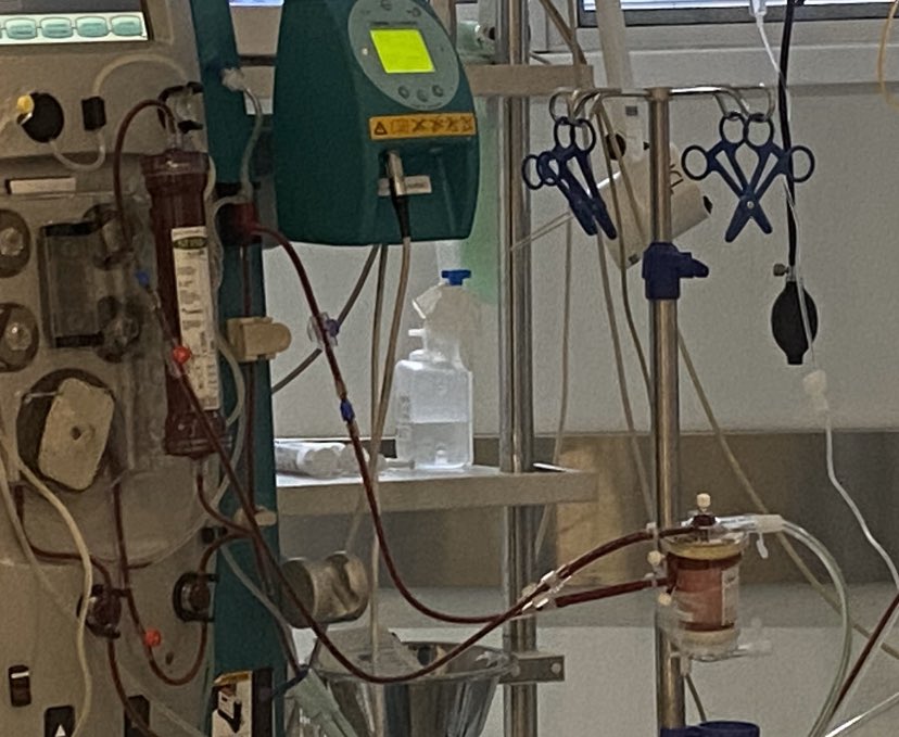 ucireinasofia's tweet photo. Extracoroporeal CO2 removal therapy (ECCO2R) en paciente COVID19 con acidosis respiratoria refractaria. Flujo 400ml/h. O2 12lpm. PCO2 99-> 56 mmHg. Buenos datos, y una terapia a tener en cuenta. https://t.co/bOGUEk6R1o
