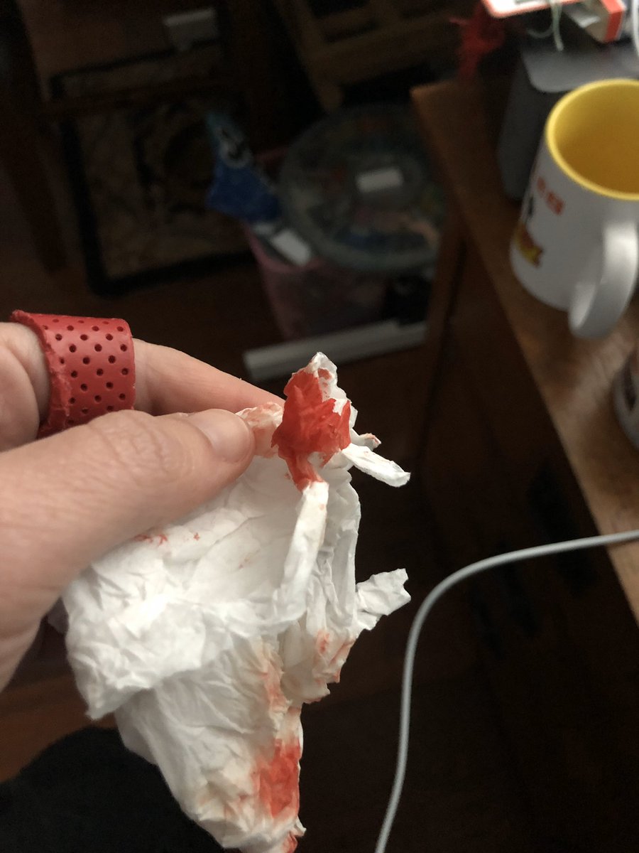 rorishapiro1's tweet photo. For today’s fun I stepped on a four inch long rusted nail outside. Bentley caught a squirrel and I tried to get him to drop it. I think I shall stay inside.
#puncturewound #injury #todaysfun https://t.co/NOqzFD2Yr4
