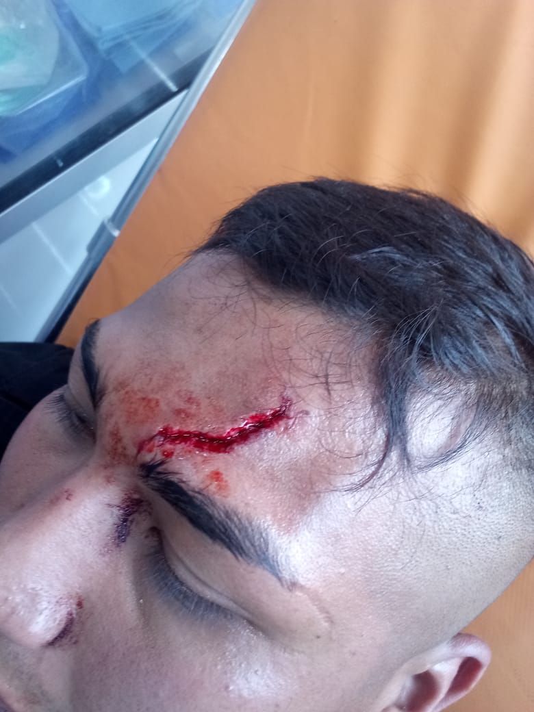 LordSalmonOnce's tweet photo. Más Agresiones a Personal Médico.

Ahora fue un paramedico en #SantaFe
#CDMX 
Santa Fe personal  de @CNPC_MX de la @AlcaldiaAO fueron agredidos por extraños por hacer su trabajo.

@SSC_CDM
@lopezobrador_
@HLGatell
@Claudiashein
@FiscaliaCDMX
@MhVigilante
@rosaicela_
@SSalud_mx https://t.co/fpWMSaGoX0
