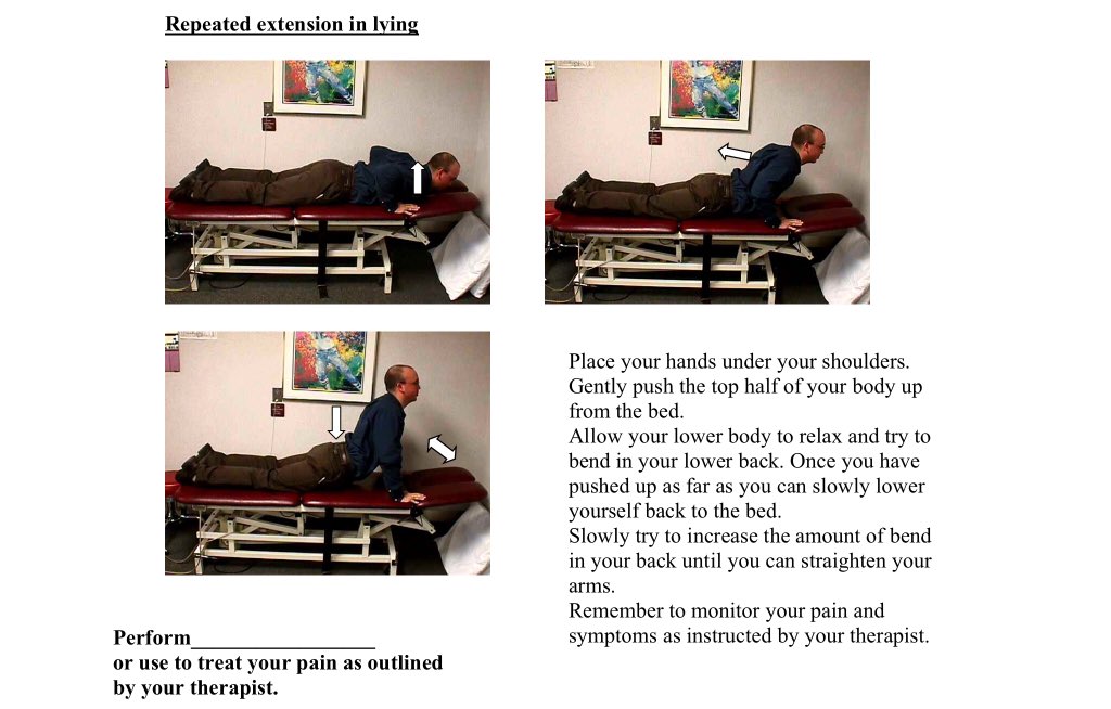 They move paradoxically. Clinical tip, if a patient gets better sitting erect, focus on lumbar extension first, if the get relief slouching, think hip extension first. In th case of doing hip extension utilizing unloaded repeated extension is advisable, monitor the symptoms..