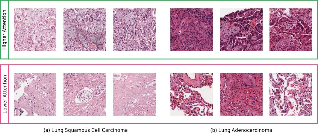 arxiv_org's tweet photo. Representation Learning of Histopathology Images using Graph Neural Networks. https://t.co/3mT99Fk2Jg https://t.co/GqC8aApM26