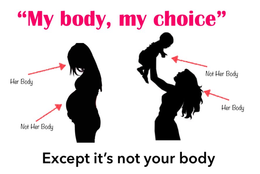 HostYahs's tweet photo. #AbortionIsMurder #QAnon  If it’s my body. My choice. My rights. Why can’t I go to work? Stay home? Go outside? Choose not to get vaxxed, chipped or any other bullshit they can come up with! Doesn’t a 👶 have a body? They go so far as to say my life... get louder right now! https://t.co/rtGpM6OvwF