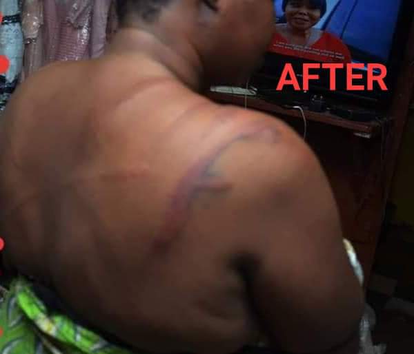 Adeyeni18's tweet image. Before and after the brutality of Tola Abdulazeez by Inspector Ikuesan Taiwo with AP NO 251724 and PC Abass Ibrahim with Force No.509634 of the Nigeria Police Force at Odo Ori Market, Iwo Osun State.

#ThisIsTotalUnacceptable,

#TolaDeserveExpressJustice,

#PoliceInhumanMustStop!