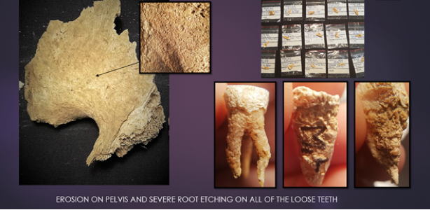 CUBALab's tweet photo. #StudentSpotlightSunday ⭐️ft PhD student @EiriniKonstant9! Eirini's thesis is an integrated taphonomic approach (macro- and microscopic analyses) focusing on the reconstruction of mortuary practices in the Neolithic caves in southwest Britain. #CUArch100 https://t.co/rvBwoClh9f