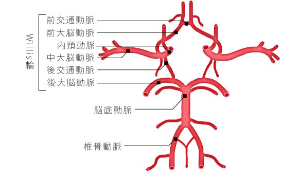 医師国家試験クイズくん 椎骨動脈解離は105a60にてハズレ選択肢として登場しています 一般に動脈の壁は内側から内膜 中膜 外膜の三層構造をしていますが このうち内膜の壁に傷がつき そこから血管の壁の中に血液が入り込み 血管が裂けていく状態が