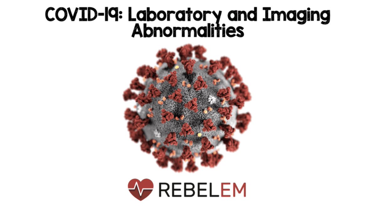 For more on this topic checkout REBEL EM: COVID-19 - Laboratory and Imaging Abnormalities  https://rebelem.com/covid-19-laboratory-and-imaging-abnormalities/  #FOAMed