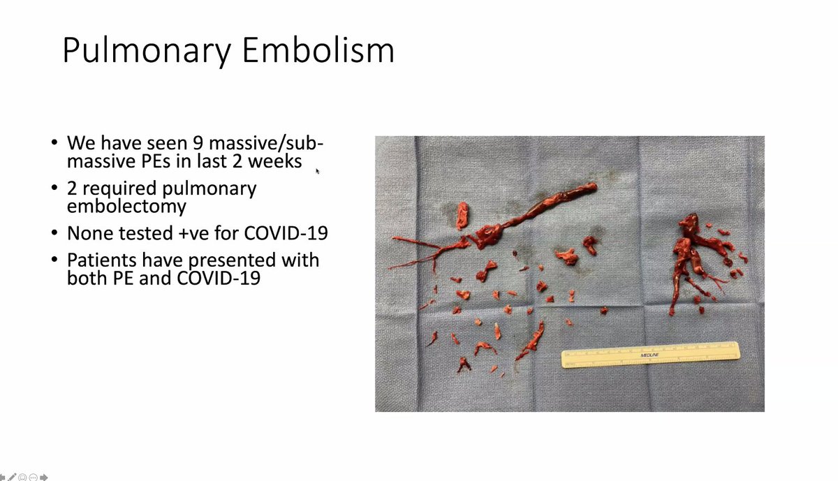 /10 Dr. Eric Lehr from Seattle:  #COVID19  @ISMICS webinarInteresting that many patients with massive pulmonary embolism, perhaps due to higher rates of CT scans?